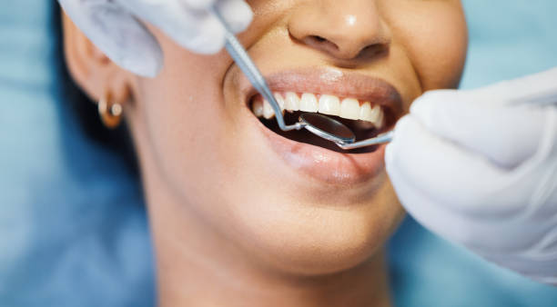Best Chipped Tooth Repair Near Me  in Pembroke, GA
